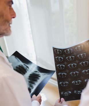 Clínica Neumológica Dr. Barros doctor revisando radiografías